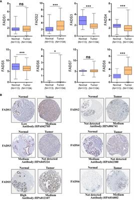 Investigating the role of FADS family members in breast cancer based on bioinformatic analysis and experimental validation